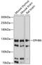 EPH Receptor B6 antibody, 15-689, ProSci, Western Blot image 