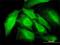 Ring Finger Protein 14 antibody, H00009604-M01, Novus Biologicals, Immunocytochemistry image 
