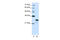 Acidic Nuclear Phosphoprotein 32 Family Member A antibody, ARP40204_T100, Aviva Systems Biology, Western Blot image 