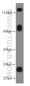 Galactosylceramidase antibody, 11991-1-AP, Proteintech Group, Western Blot image 