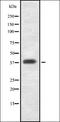 Damage Specific DNA Binding Protein 2 antibody, orb335249, Biorbyt, Western Blot image 