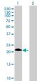 Ankyrin Repeat And SOCS Box Containing 6 antibody, H00140459-B01P, Novus Biologicals, Western Blot image 