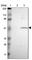 Cholinergic Receptor Nicotinic Beta 1 Subunit antibody, HPA005822, Atlas Antibodies, Western Blot image 