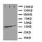 TNF Receptor Superfamily Member 10a antibody, LS-C313106, Lifespan Biosciences, Western Blot image 