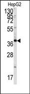 SH3 Domain Containing GRB2 Like, Endophilin B1 antibody, AP14959PU-N, Origene, Western Blot image 