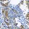 Patched 1 antibody, GTX64432, GeneTex, Immunohistochemistry paraffin image 