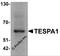 Thymocyte Expressed, Positive Selection Associated 1 antibody, 7601, ProSci, Western Blot image 