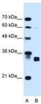 Carbonyl Reductase 1 antibody, TA338914, Origene, Western Blot image 