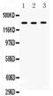 Reticulon 3 antibody, PA5-79941, Invitrogen Antibodies, Western Blot image 