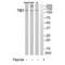 Tie-1 antibody, A02206, Boster Biological Technology, Western Blot image 