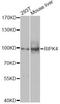Receptor Interacting Serine/Threonine Kinase 4 antibody, A8495, ABclonal Technology, Western Blot image 