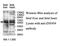 Zinc Finger Protein 454 antibody, MBS416685, MyBioSource, Western Blot image 