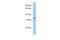 Zinc Finger Protein 584 antibody, A17637, Boster Biological Technology, Western Blot image 