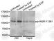 Insulin Receptor antibody, AP0042, ABclonal Technology, Western Blot image 