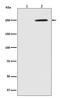 Eukaryotic Translation Initiation Factor 2 Alpha Kinase 4 antibody, P01172, Boster Biological Technology, Western Blot image 