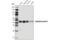 SWI/SNF Related, Matrix Associated, Actin Dependent Regulator Of Chromatin, Subfamily B, Member 1 antibody, 8745S, Cell Signaling Technology, Western Blot image 