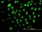 Helicase With Zinc Finger antibody, H00009931-M02, Novus Biologicals, Immunofluorescence image 