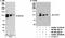 DEAD-Box Helicase 20 antibody, NB100-1801, Novus Biologicals, Western Blot image 