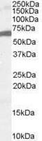 Forkhead Box A2 antibody, PA1-31936, Invitrogen Antibodies, Western Blot image 