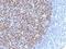 BCL6 Transcription Repressor antibody, M00142, Boster Biological Technology, Immunohistochemistry frozen image 