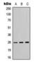 Tyrosine 3-Monooxygenase/Tryptophan 5-Monooxygenase Activation Protein Theta antibody, orb224073, Biorbyt, Western Blot image 