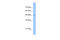 Tigger transposable element-derived protein 3 antibody, 30-494, ProSci, Western Blot image 