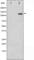 Platelet Derived Growth Factor Receptor Beta antibody, abx011956, Abbexa, Western Blot image 