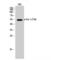 ETS Proto-Oncogene 1, Transcription Factor antibody, LS-C381466, Lifespan Biosciences, Western Blot image 