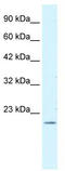 CAGH44 antibody, TA334254, Origene, Western Blot image 