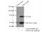 CDKN2A Interacting Protein antibody, 16615-1-AP, Proteintech Group, Immunoprecipitation image 