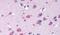 G Protein-Coupled Receptor Class C Group 6 Member A antibody, PA5-33808, Invitrogen Antibodies, Immunohistochemistry paraffin image 