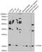 CD160 Molecule antibody, GTX55554, GeneTex, Western Blot image 