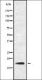 Regulator Of G Protein Signaling 21 antibody, orb338643, Biorbyt, Western Blot image 