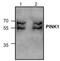 Serine/threonine-protein kinase PINK1, mitochondrial antibody, TA319006, Origene, Western Blot image 