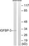 Insulin Like Growth Factor Binding Protein 3 antibody, LS-C117957, Lifespan Biosciences, Western Blot image 