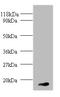 Heparin-binding growth factor 1 antibody, A52780-100, Epigentek, Western Blot image 