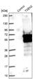 TRNA Splicing Endonuclease Subunit 2 antibody, NBP1-81142, Novus Biologicals, Western Blot image 