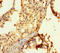 Exosome Component 3 antibody, LS-C397955, Lifespan Biosciences, Immunohistochemistry paraffin image 