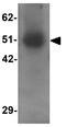 Ras association domain-containing protein 10 antibody, GTX32014, GeneTex, Western Blot image 