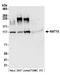 N-Acetyltransferase 10 antibody, A304-385A, Bethyl Labs, Western Blot image 