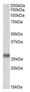 Synaptosome Associated Protein 23 antibody, AP21296PU-N, Origene, Western Blot image 