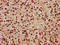 Lin-9 DREAM MuvB Core Complex Component antibody, LS-C680775, Lifespan Biosciences, Immunohistochemistry paraffin image 