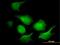 Adenylate Kinase 1 antibody, MA5-18367, Invitrogen Antibodies, Immunofluorescence image 