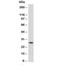 Immunoglobulin Kappa Variable 1D-16 antibody, orb385813, Biorbyt, Western Blot image 