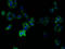 Transmembrane Protein 14B antibody, A57878-100, Epigentek, Immunofluorescence image 