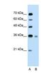 Ubiquitin Conjugating Enzyme E2 J1 antibody, NBP1-59757, Novus Biologicals, Western Blot image 