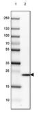Transgelin 3 antibody, PA5-64039, Invitrogen Antibodies, Western Blot image 