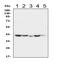 Serpin Family B Member 5 antibody, PB9356, Boster Biological Technology, Western Blot image 