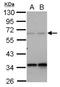 Protein Phosphatase 4 Regulatory Subunit 2 antibody, NBP2-19915, Novus Biologicals, Western Blot image 