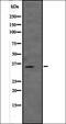 Vestigial Like Family Member 2 antibody, orb335085, Biorbyt, Western Blot image 